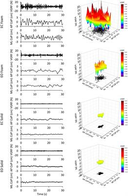 Vertical ground reaction force oscillation during standing on hard and compliant surfaces: The “postural rhythm”